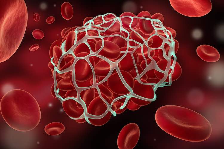 7 Foods to Prevent a Deadly Blood Clot